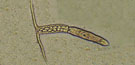 Cotylurus sp.