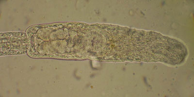 Diplostomum sp.