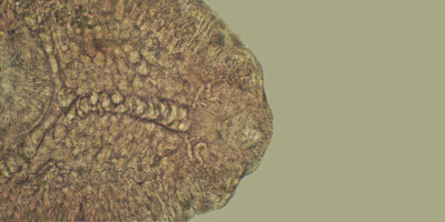 Echinoparyphium aconiatum
