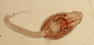 Echinostoma echinatum 