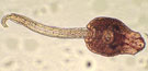 Echinostoma robustum
