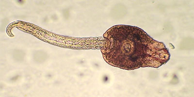 Echinostoma echinatum