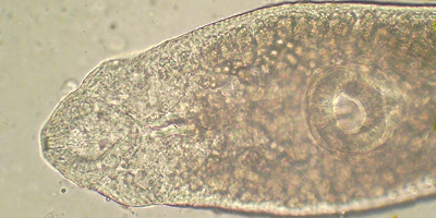 Echinostoma echinatum