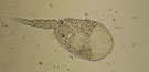 Haplometra cylindracea