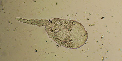 Haplometra cylindracea