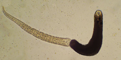 Notocotylus attenuatus