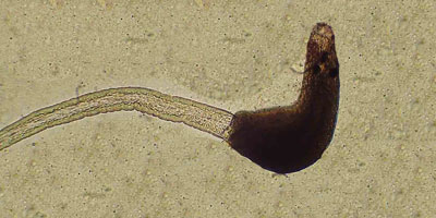 Notocotylus ephemera