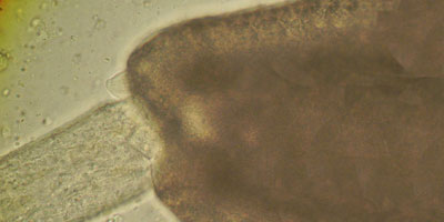 Notocotylus ephemera