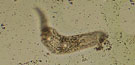 Plagiorchis elegans