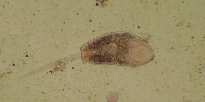 Plagiorchis laricola