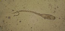 Schistosomatidae gen. sp.