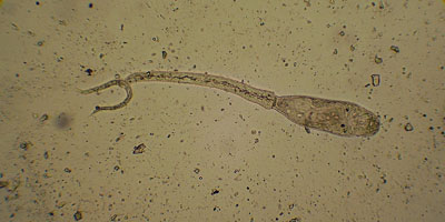 Schistosomatidae gen. sp.