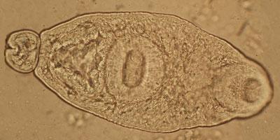 Sphaerostomum bramae