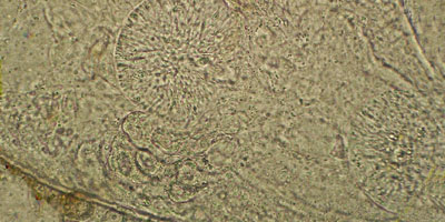 Paralepoderma brumpti